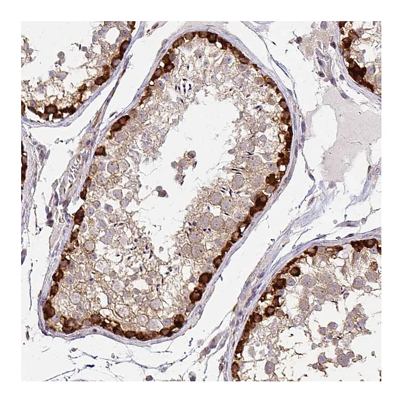Atlas Antibodies Anti-ARHGAP35 Antibody