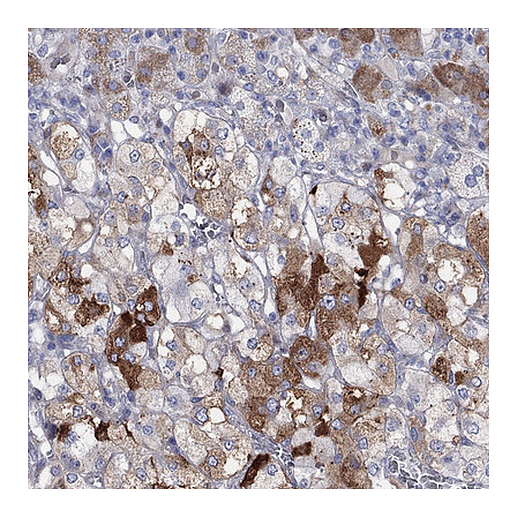 Atlas Antibodies Anti-ARHGAP36 Antibody