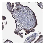 Atlas Antibodies Anti-ARHGAP42 Antibody