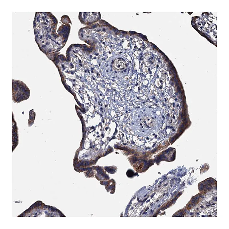 Atlas Antibodies Anti-ARHGAP42 Antibody