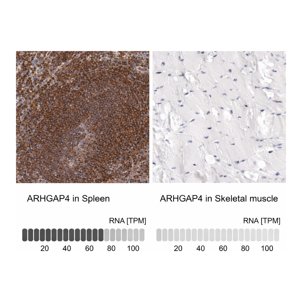 Atlas Antibodies Anti-ARHGAP4 Antibody