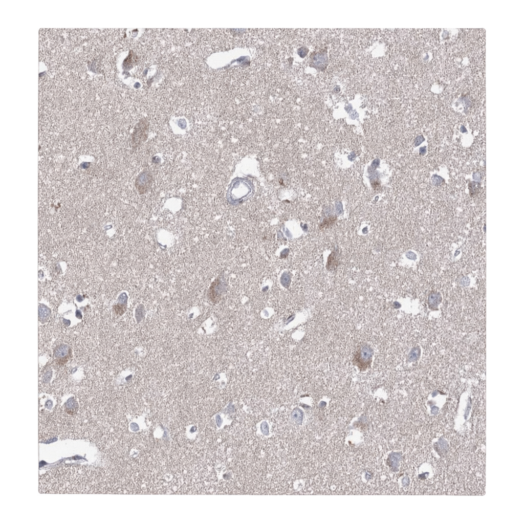 Atlas Antibodies Anti-ARHGAP44 Antibody