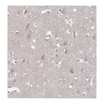 Atlas Antibodies Anti-ARHGAP44 Antibody