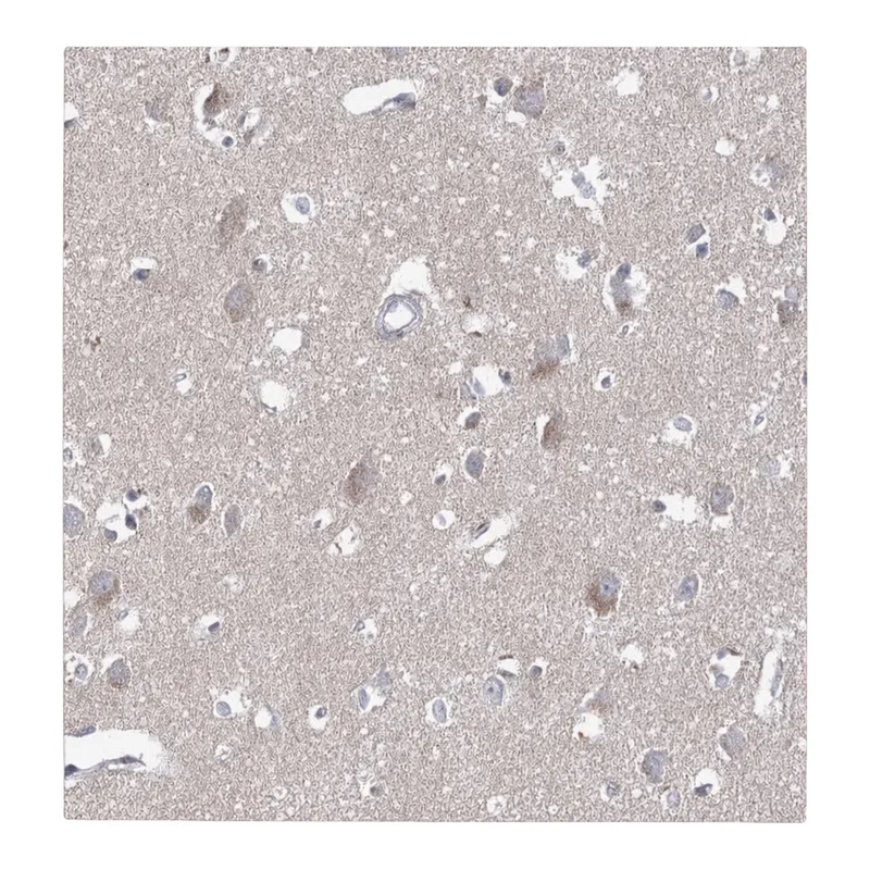 Atlas Antibodies Anti-ARHGAP44 Antibody