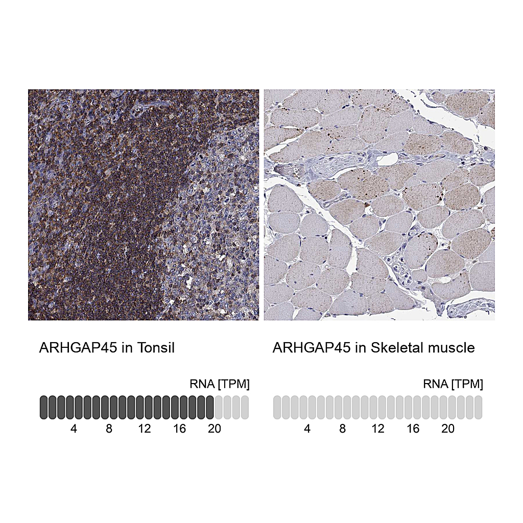 Atlas Antibodies Anti-ARHGAP45 Antibody