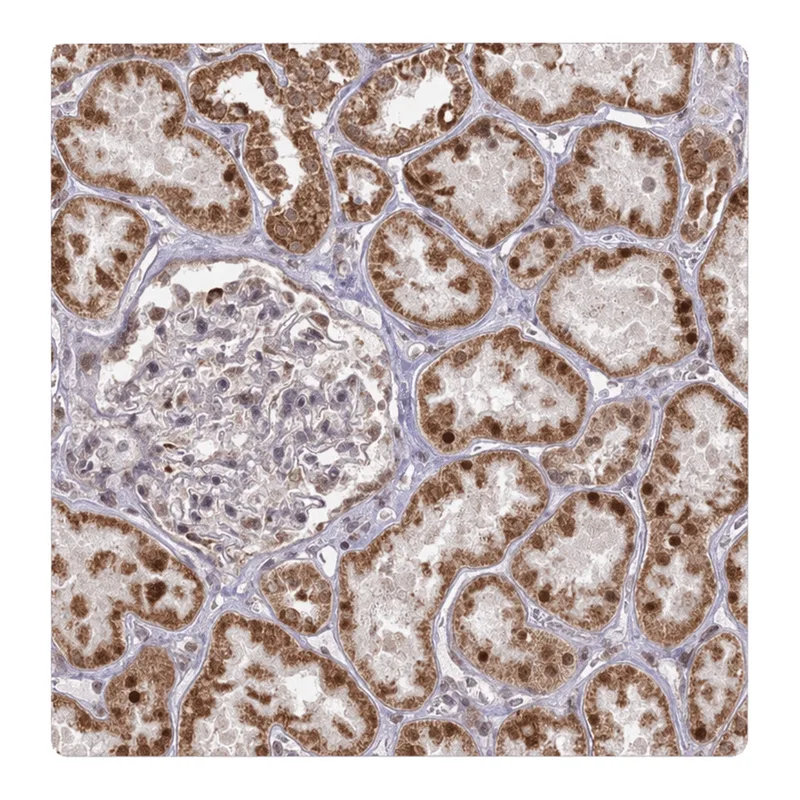 Atlas Antibodies Anti-ARHGAP40 Antibody