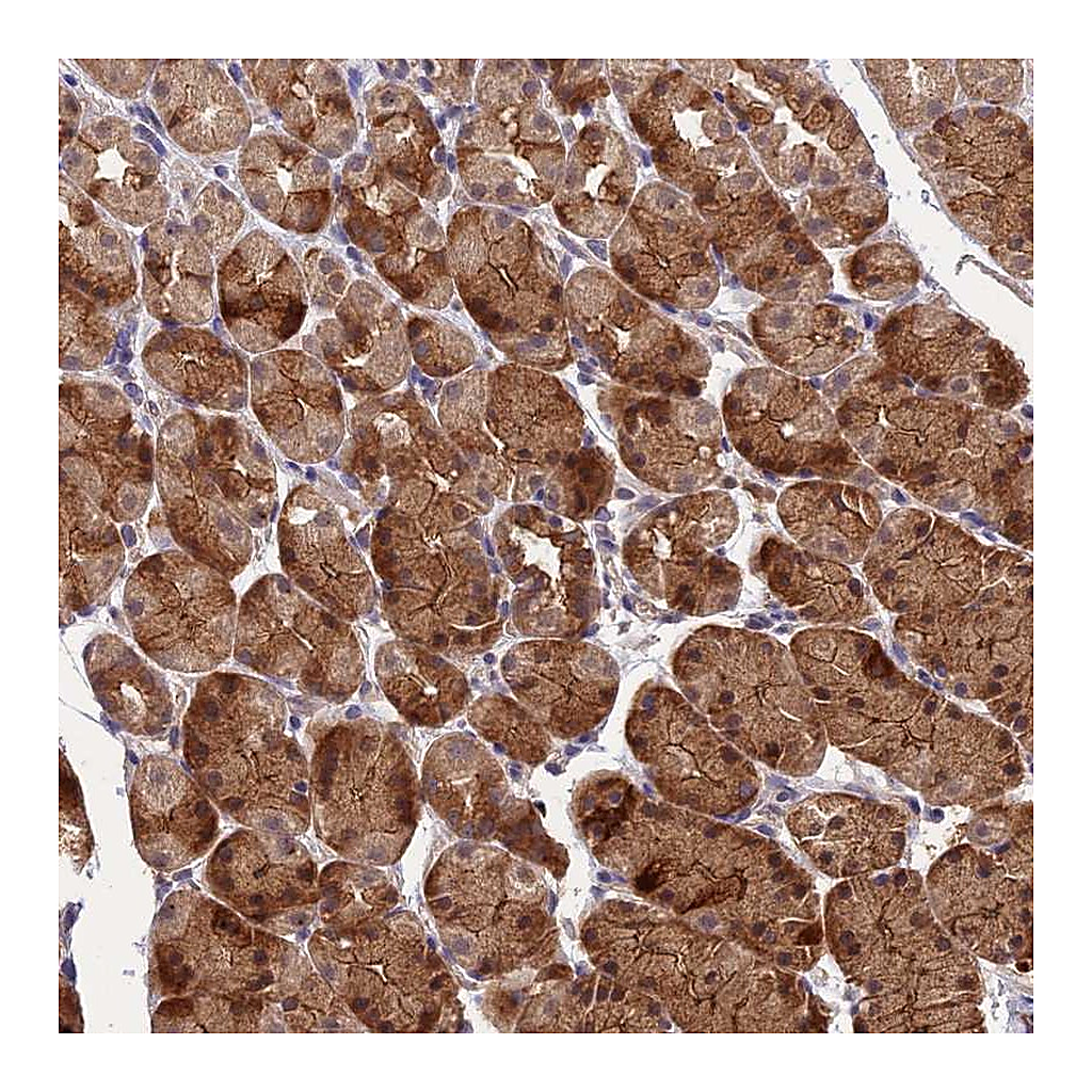 Atlas Antibodies Anti-ARHGAP40 Antibody