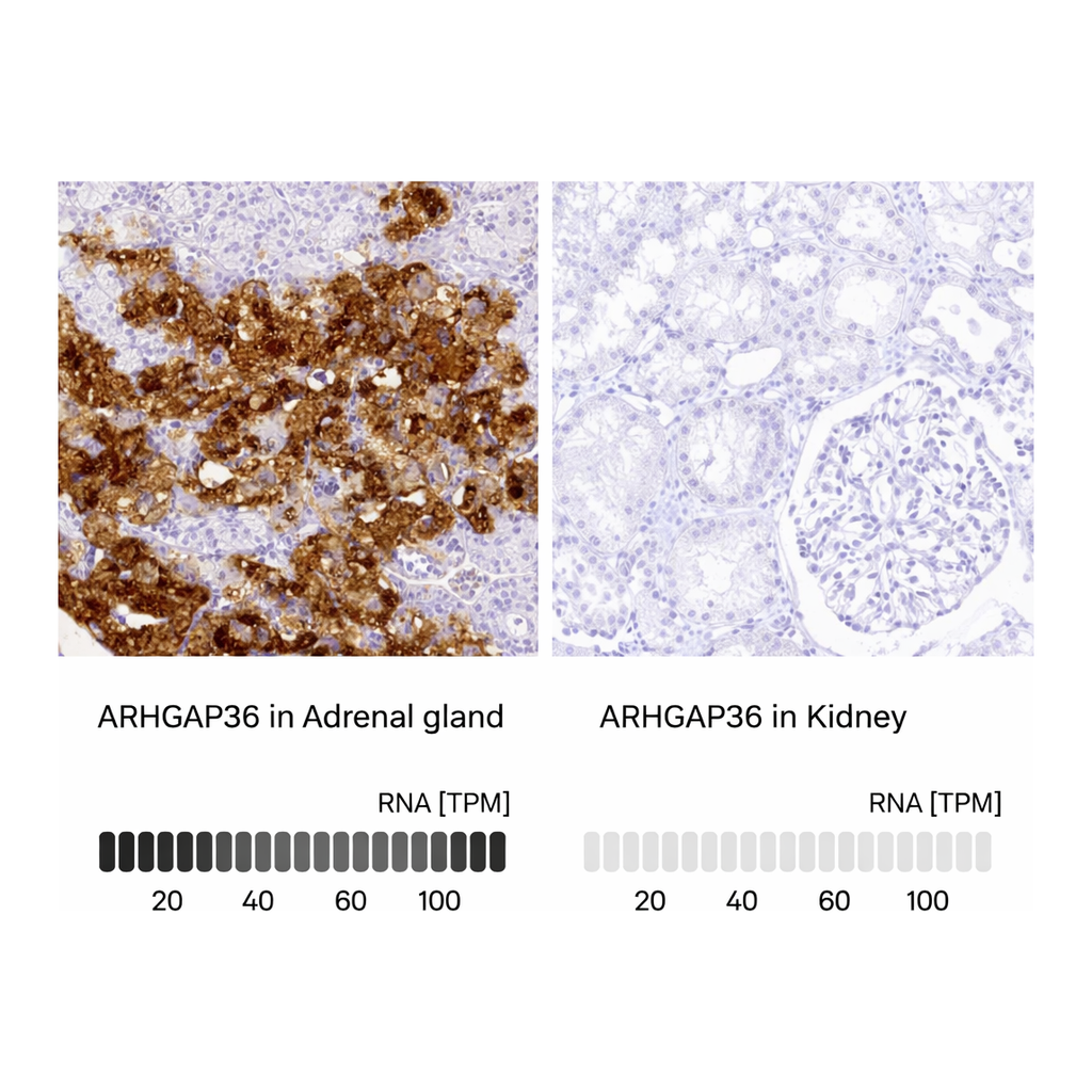 Atlas Antibodies Anti-ARHGAP36 Antibody