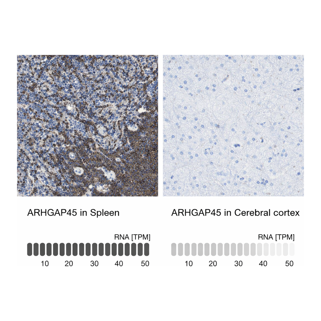 Atlas Antibodies Anti-ARHGAP45 Antibody