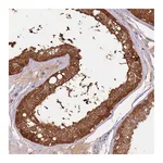 Atlas Antibodies Anti-ARHGAP5 Antibody