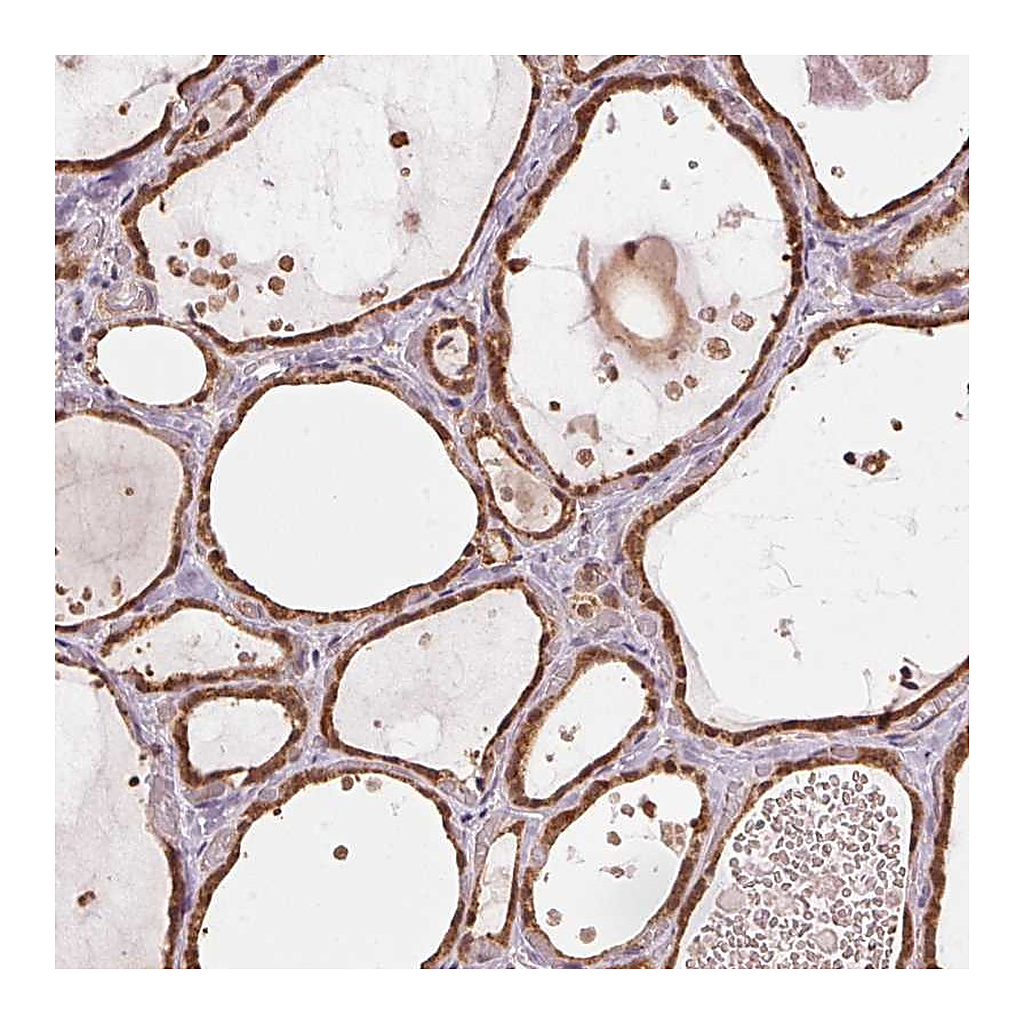 Atlas Antibodies Anti-ARHGAP6 Antibody