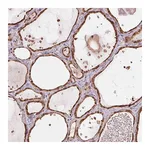 Atlas Antibodies Anti-ARHGAP6 Antibody