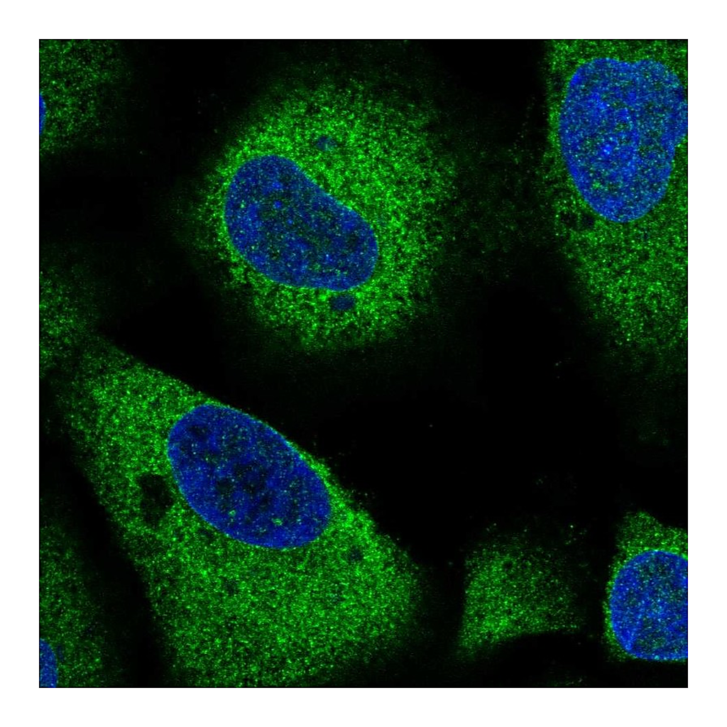 Atlas Antibodies Anti-ARHGAP5 Antibody