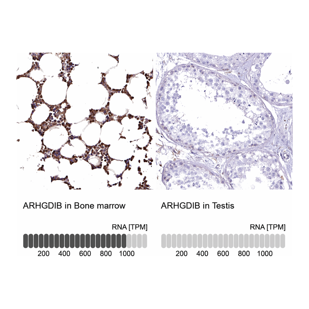 Atlas Antibodies Anti-ARHGDIB Antibody