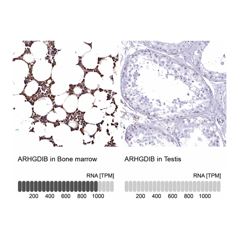Atlas Antibodies Anti-ARHGDIB Antibody