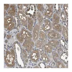 Atlas Antibodies Anti-ARHGDIA Antibody