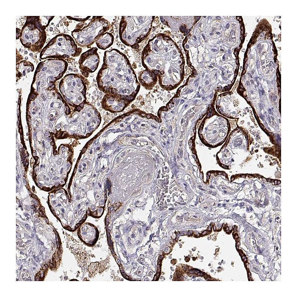 Atlas Antibodies Anti-ARHGAP8 Antibody