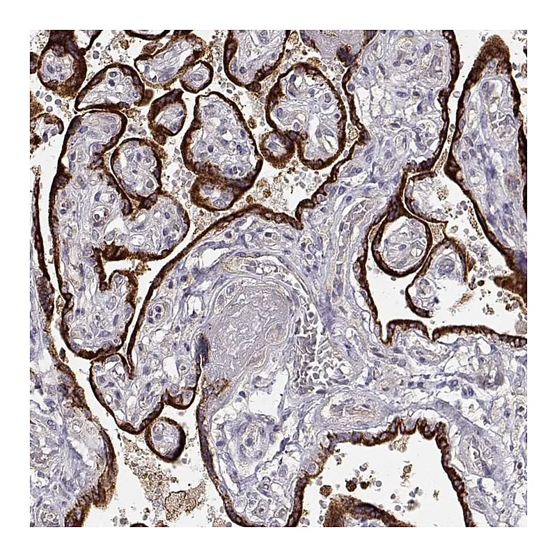 Atlas Antibodies Anti-ARHGAP8 Antibody