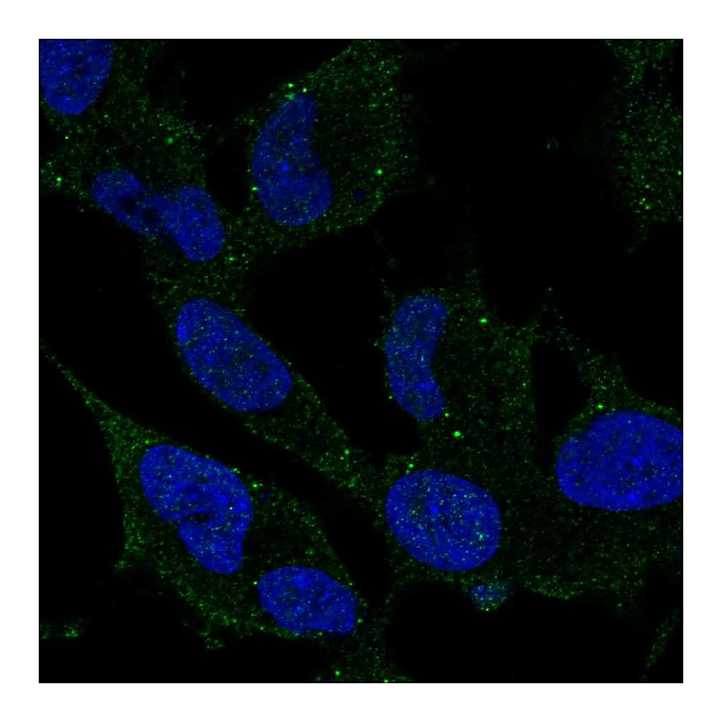 Atlas Antibodies Anti-ARHGDIG Antibody