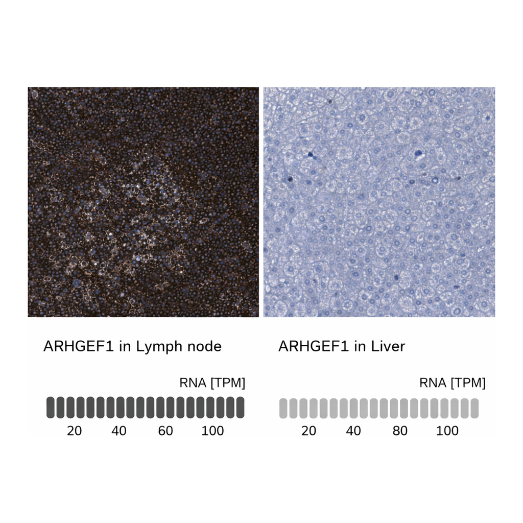 Atlas Antibodies Anti-ARHGEF1 Antibody