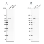Atlas Antibodies Anti-ARHGEF1 Antibody