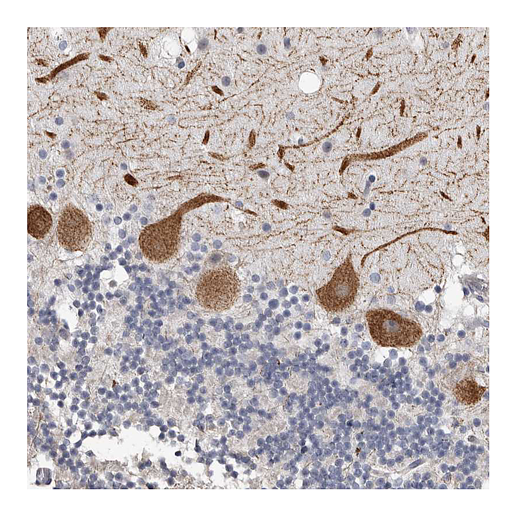 Atlas Antibodies Anti-ARHGEF10 Antibody