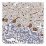 Atlas Antibodies Anti-ARHGEF10 Antibody