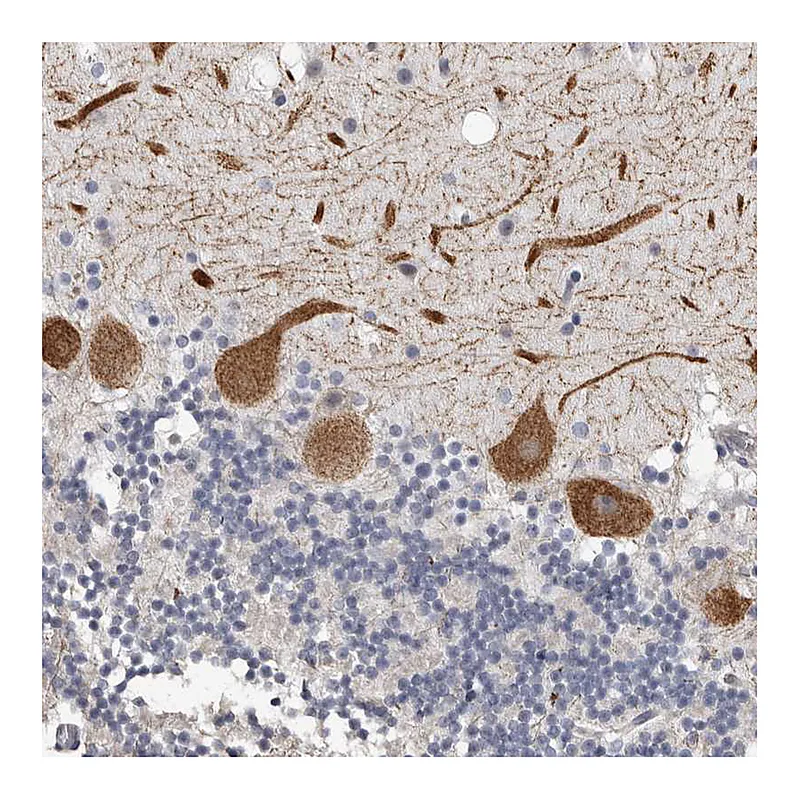 Atlas Antibodies Anti-ARHGEF10 Antibody