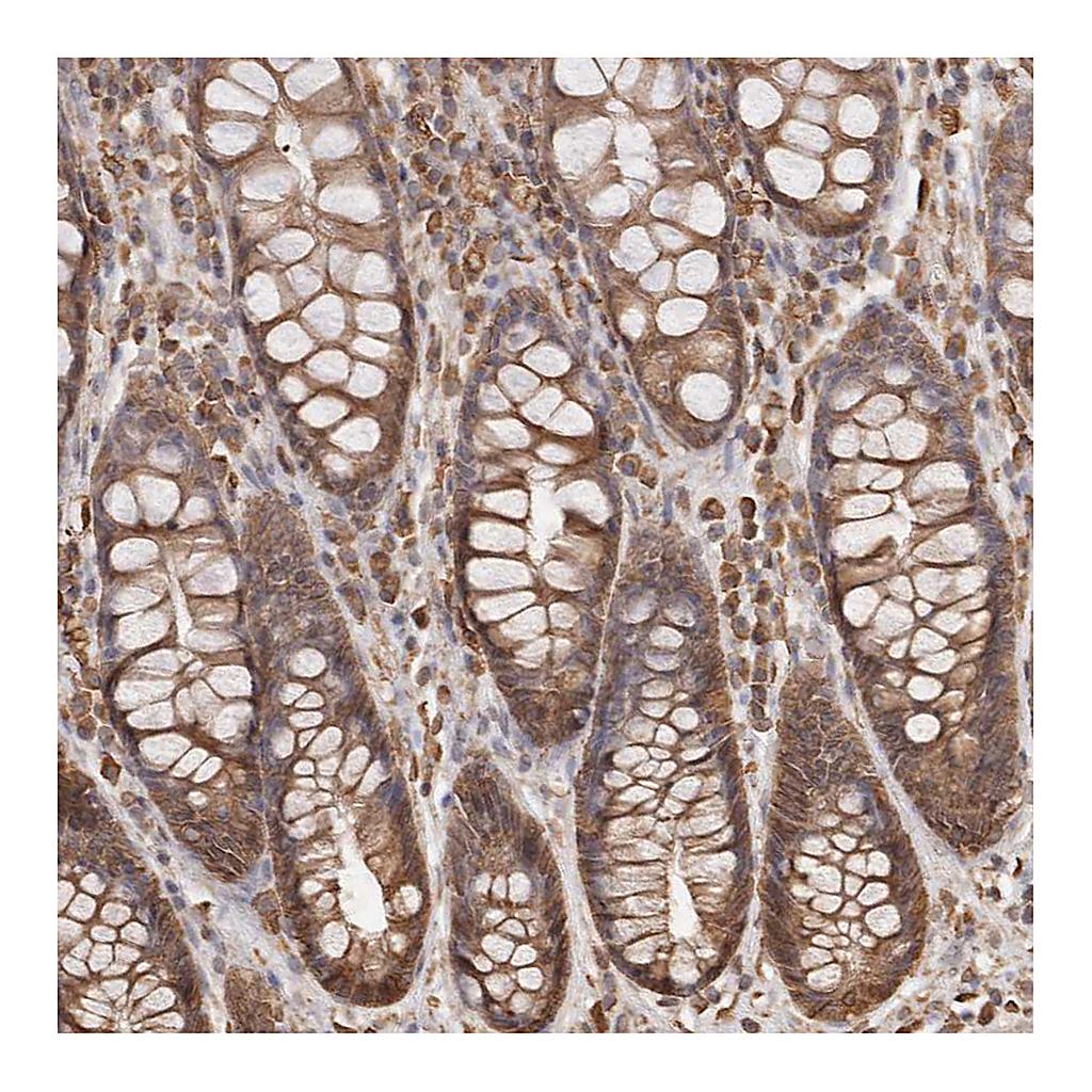 Atlas Antibodies Anti-ARHGEF10L Antibody