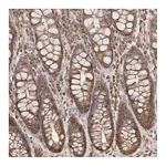 Atlas Antibodies Anti-ARHGEF10L Antibody