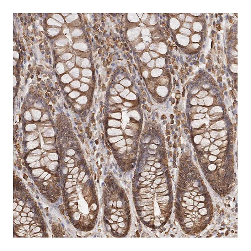 Atlas Antibodies Anti-ARHGEF10L Antibody
