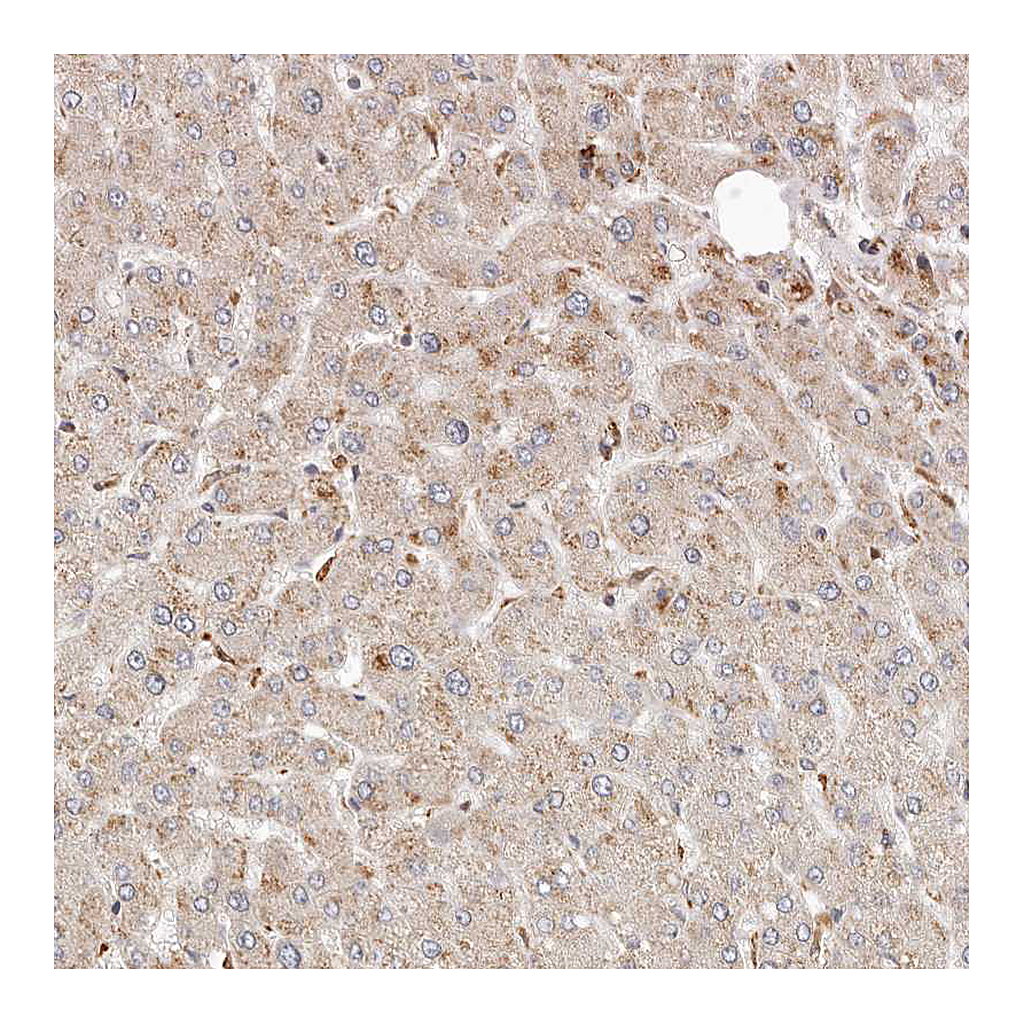 Atlas Antibodies Anti-ARHGEF10L Antibody