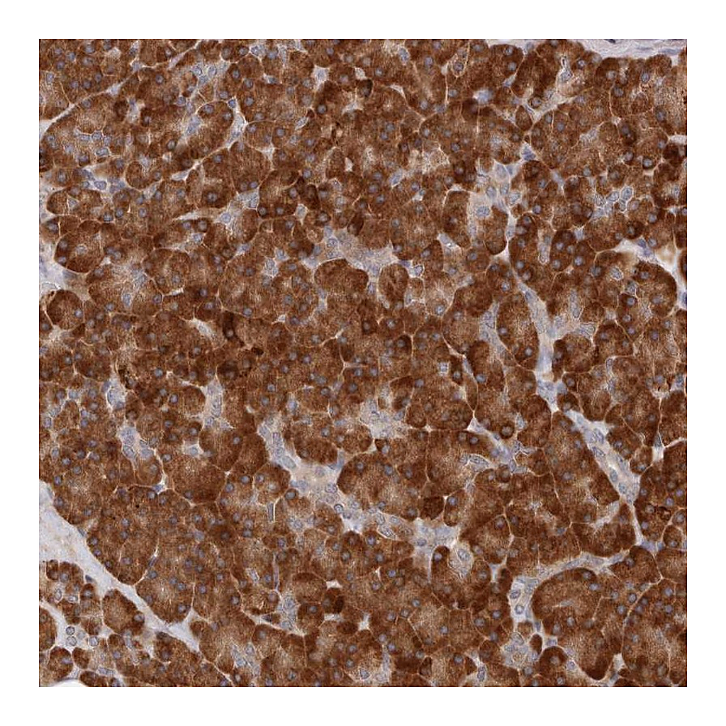 Atlas Antibodies Anti-ARHGEF10L Antibody