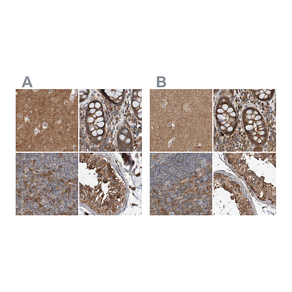 Atlas Antibodies Anti-ARHGEF11 Antibody