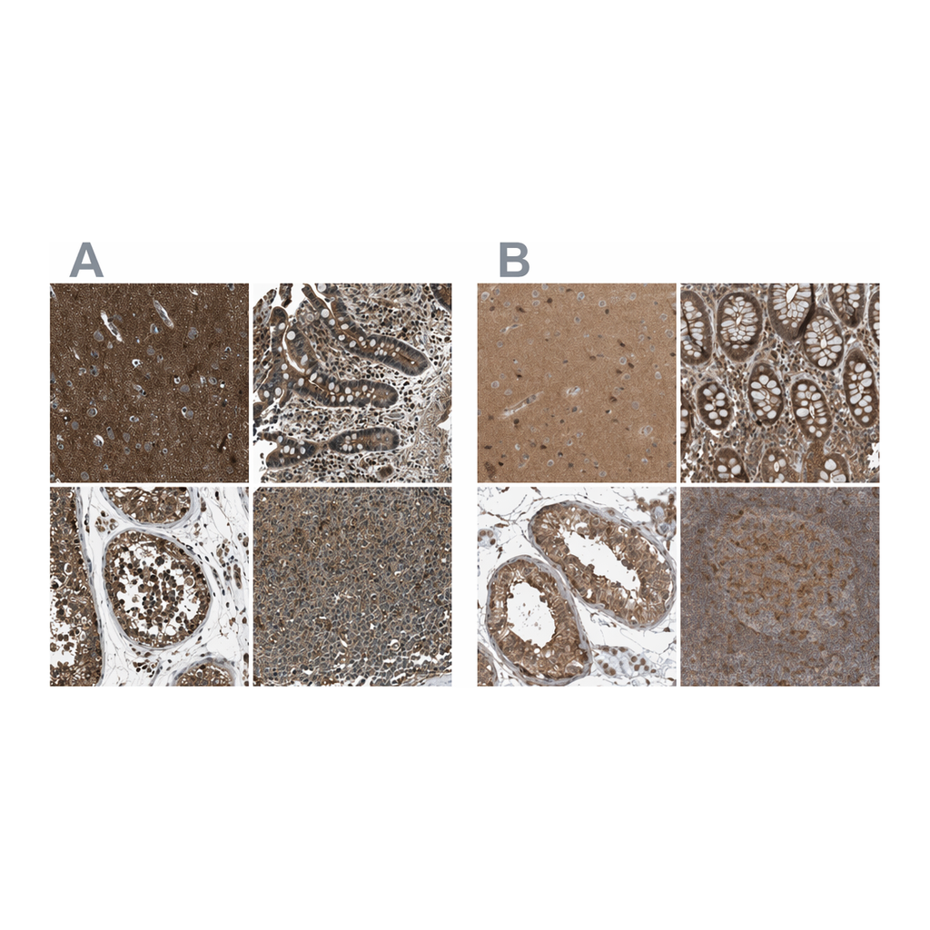 Atlas Antibodies Anti-ARHGEF11 Antibody