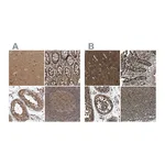 Atlas Antibodies Anti-ARHGEF11 Antibody
