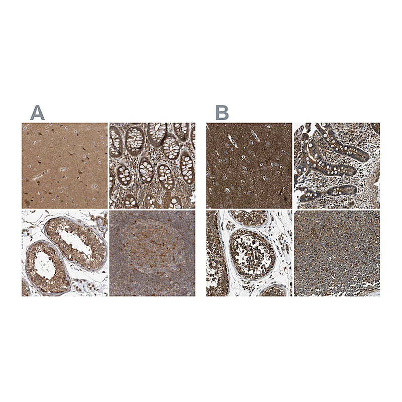 Atlas Antibodies Anti-ARHGEF11 Antibody