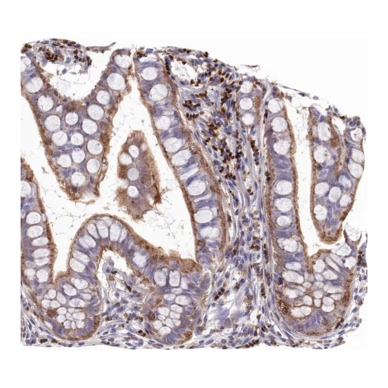 Atlas Antibodies Anti-ARHGEF18 Antibody