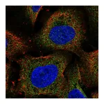 Atlas Antibodies Anti-ARHGEF18 Antibody