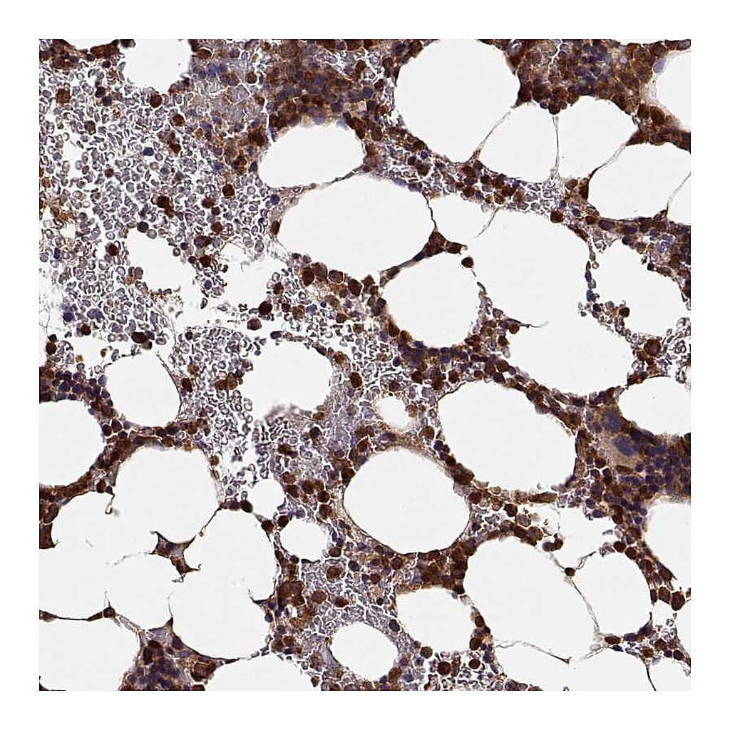Atlas Antibodies Anti-ARHGEF2 Antibody