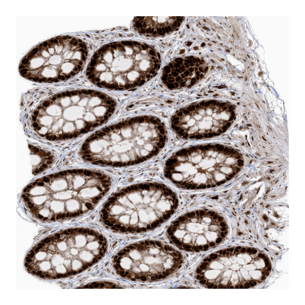 Atlas Antibodies Anti-ARHGEF3 Antibody