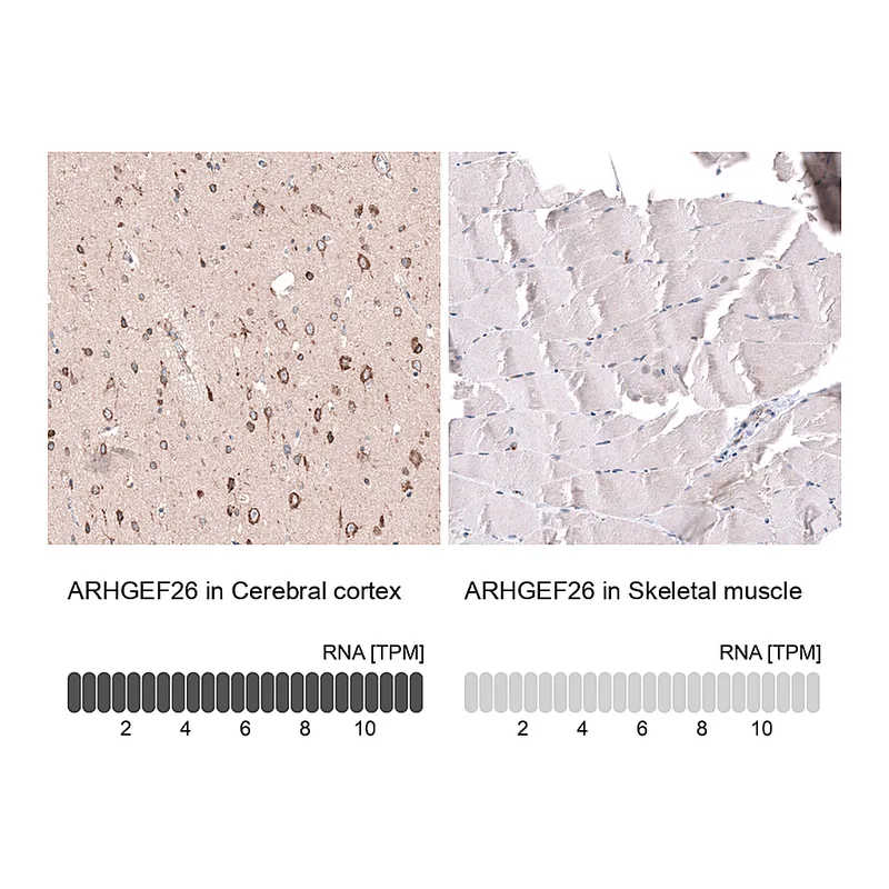 Atlas Antibodies Anti-ARHGEF26 Antibody