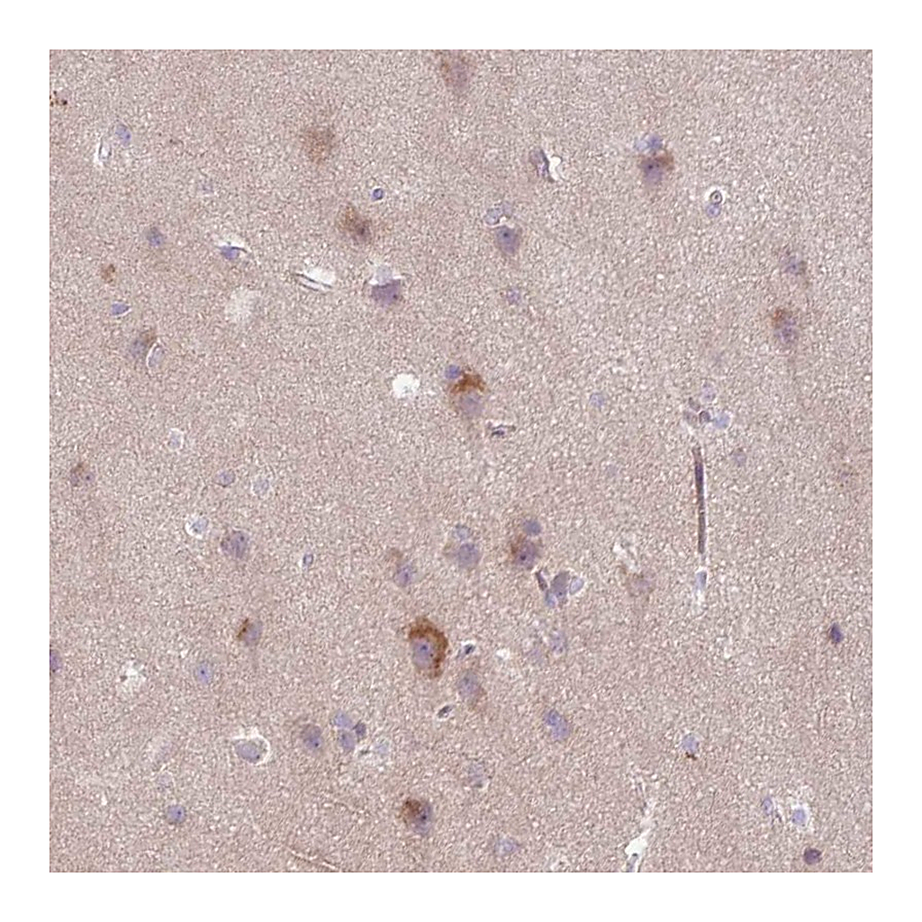 Atlas Antibodies Anti-ARHGEF25 Antibody