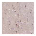 Atlas Antibodies Anti-ARHGEF25 Antibody