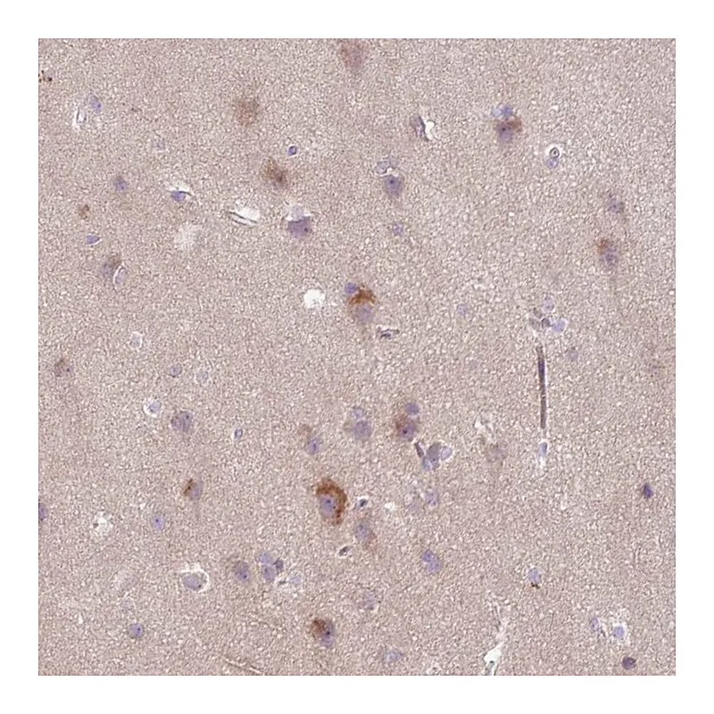 Atlas Antibodies Anti-ARHGEF25 Antibody