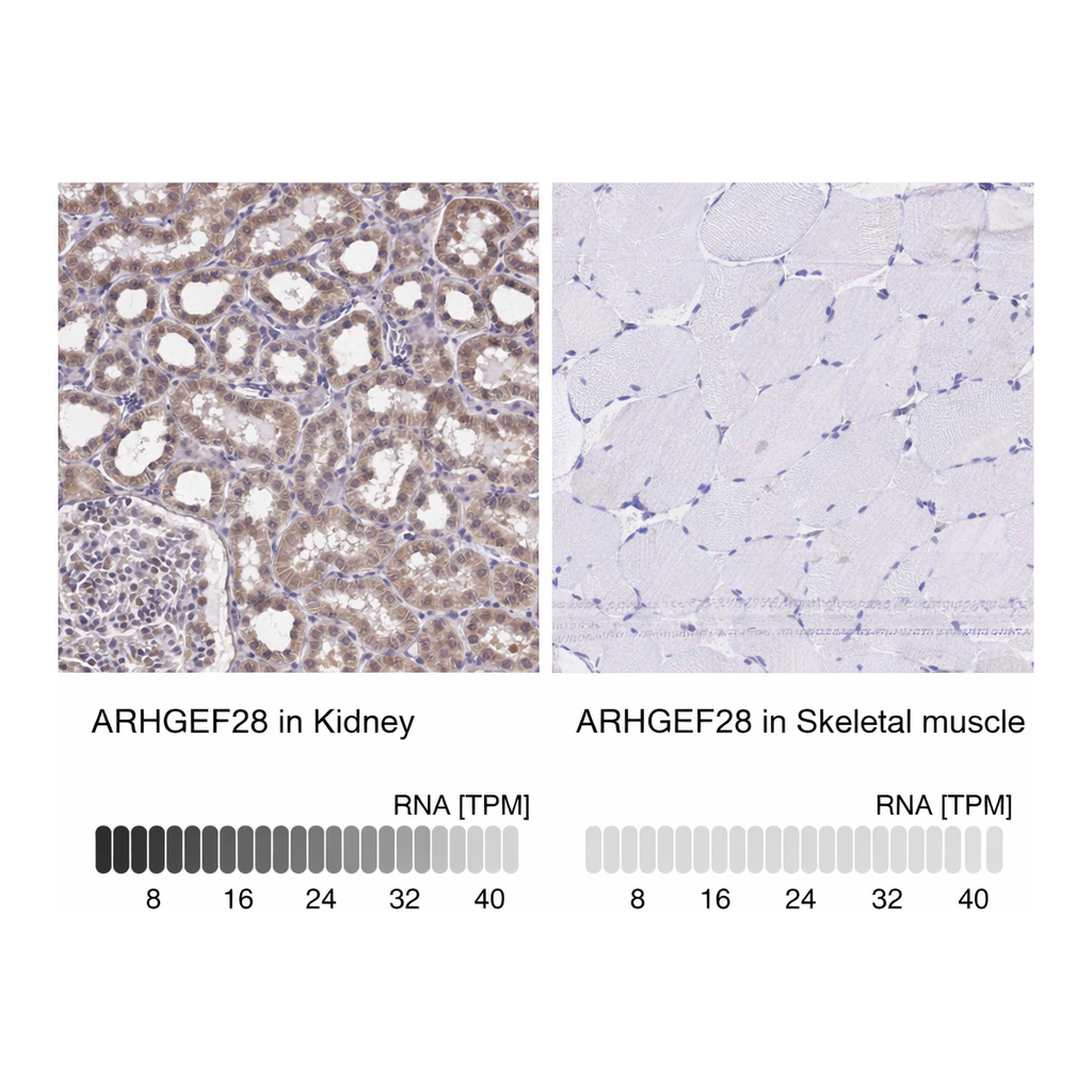 Atlas Antibodies Anti-ARHGEF28 Antibody
