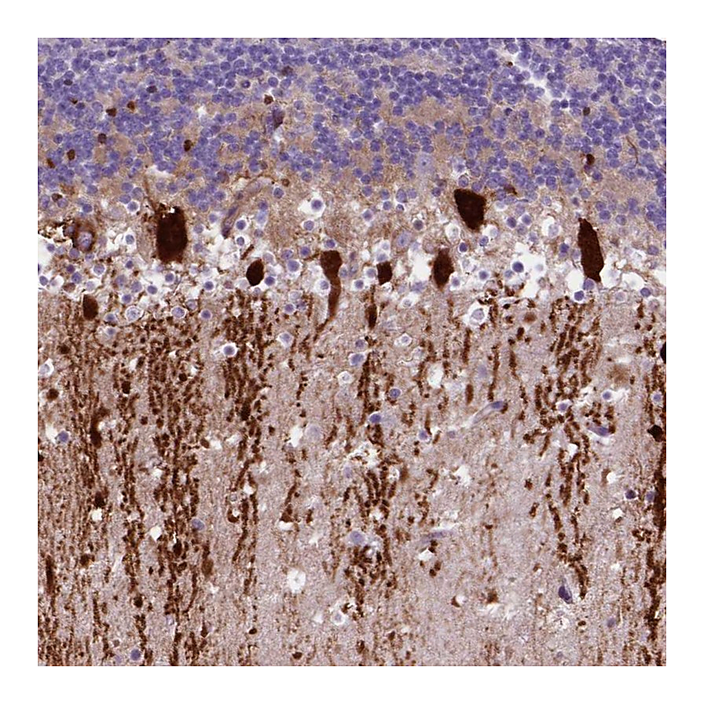 Atlas Antibodies Anti-ARHGEF33 Antibody
