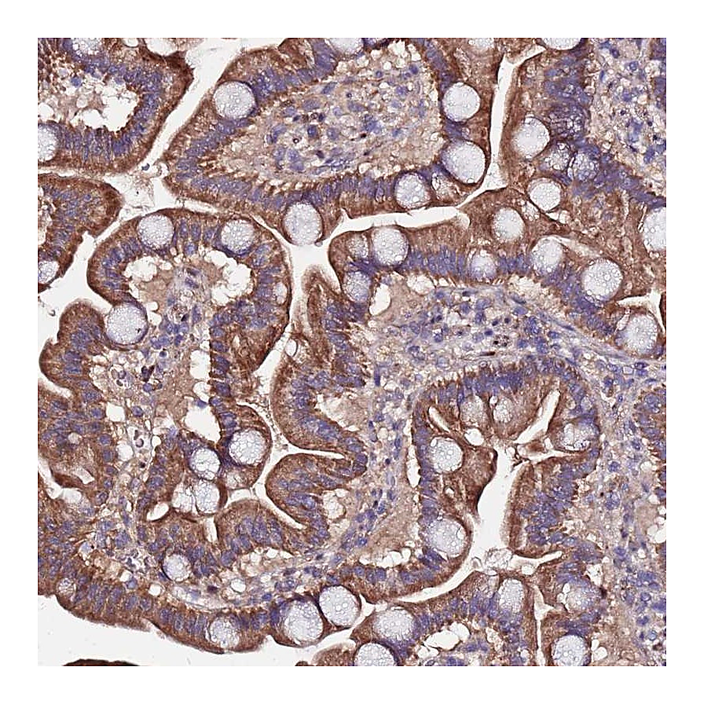 Atlas Antibodies Anti-ARHGEF35 Antibody