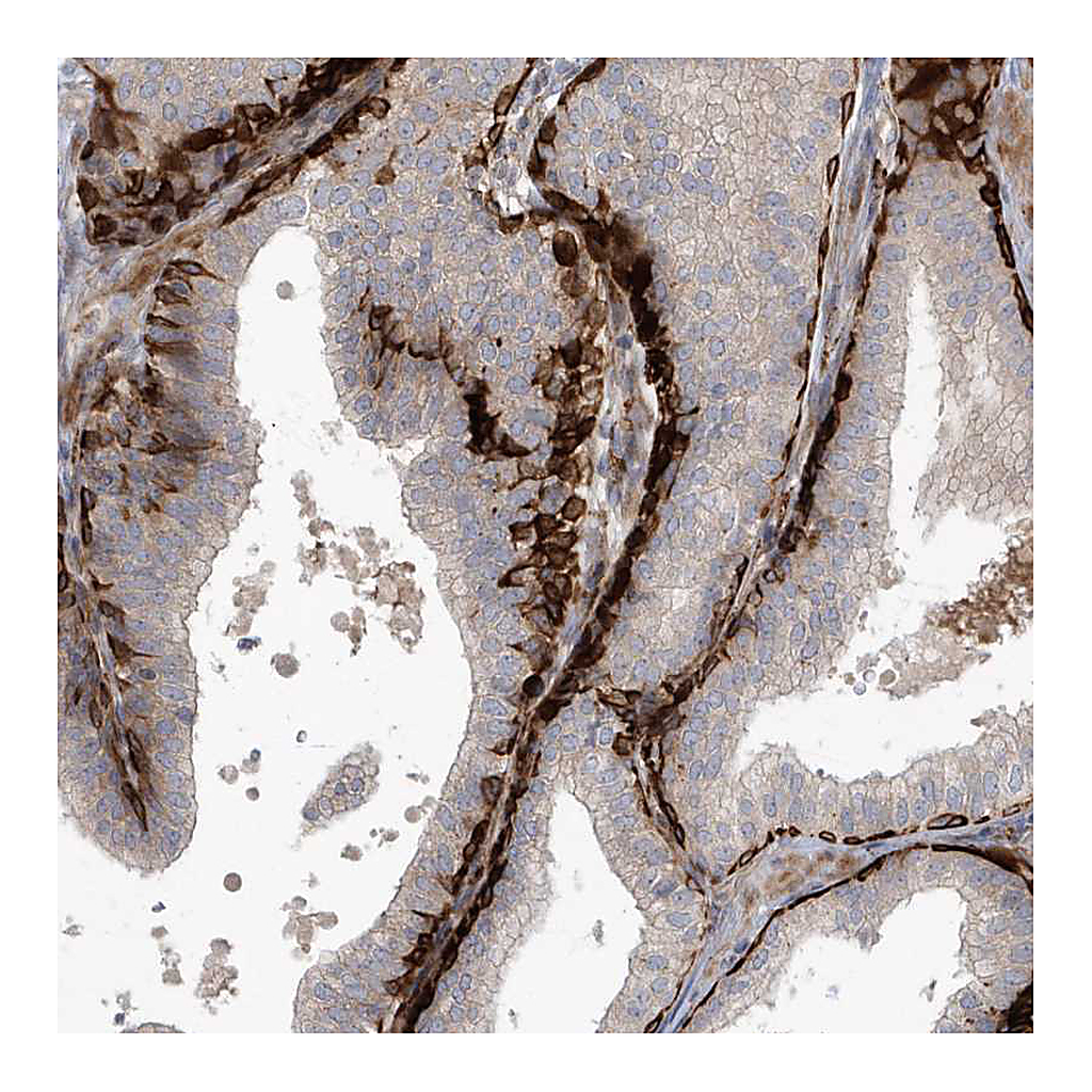 Atlas Antibodies Anti-ARHGEF38 Antibody
