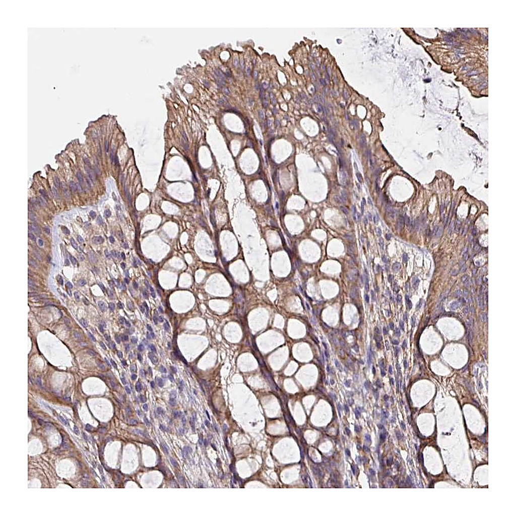 Atlas Antibodies Anti-ARHGEF39 Antibody